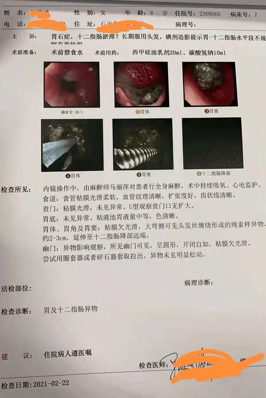 吃糖葫芦长出胃结石，警示与健康科普