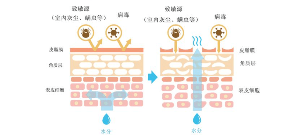 网上爆火的以油养肤真的有用吗？一文探究其真相